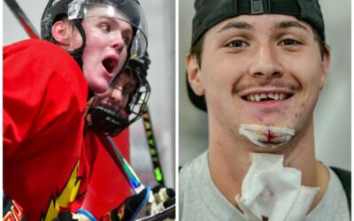 Spittin’ Chiclets